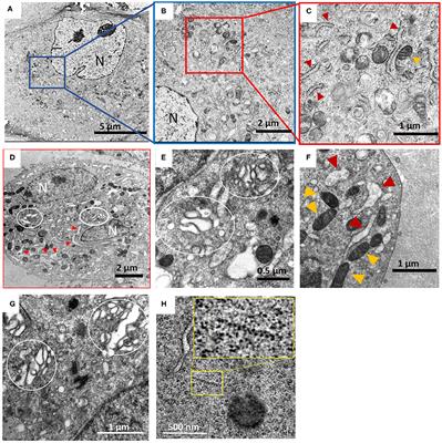 Cryofixation of Inactivated Hantavirus-Infected Cells as a Method for Obtaining High-Quality Ultrastructural Preservation for Electron Microscopic Studies